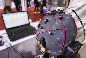 廣東腦機接口“指導(dǎo)價”：置入費最高6600元，取出費最高3200元