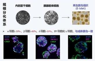 我國團(tuán)隊(duì)推出再生胰島微創(chuàng)移植